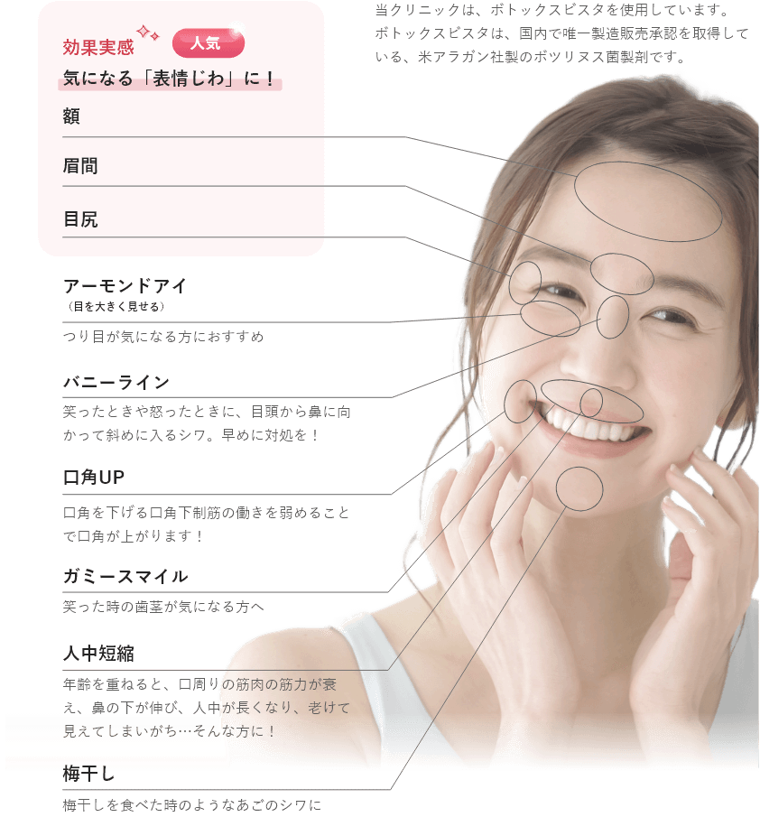 ボトックス施術部位（顔）