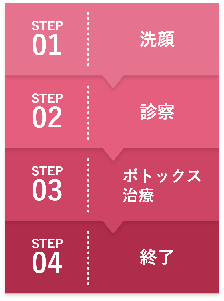 STEP1:洗顔、STEP2:診察、STEP3:ボトックス治療、STEP4:終了