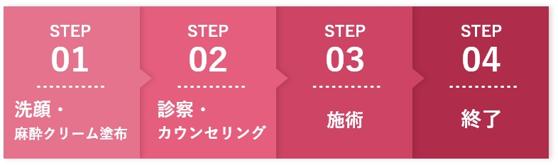 STEP1:洗顔・ 麻酔クリーム塗布、STEP2:診察・ カウンセリング、STEP3:施術、STEP4:終了